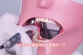牙科医生打麻醉演示，看完敢去拔牙了！视频封面