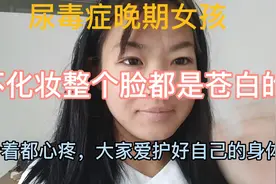 尿毒症女孩透析时间久了，脸色都是苍白的，每天化妆掩盖憔悴的脸视频封面