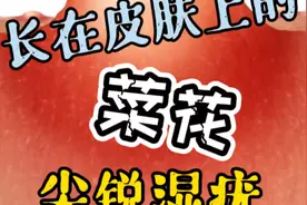长在皮肤上的“菜花”—尖锐湿疣视频封面