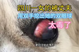 四川一女的被丈夫用手挖出双眼球太狠毒了。视频封面