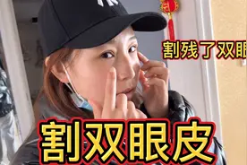 媳妇儿在呼和浩特自己悄悄地割了双眼皮，黑豆觉得没有以前漂亮了视频封面