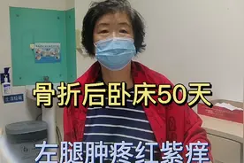 骨折后卧床50天，左腿肿疼红紫痒，如何避免？视频封面