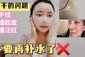 70后阿姨用油4年，解决所有皮肤干燥起皮泛红问题，无细纹不长斑视频封面