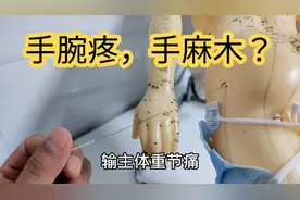 腕管综合症，手腕疼痛，手麻，手木的针灸治疗！视频封面