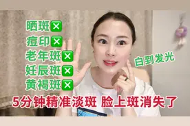 脸上的斑点终于消失了5分钟淡斑法，成本不到两块钱皮肤白到发光