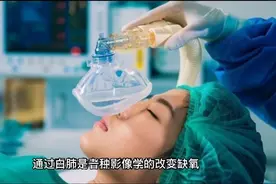 什么是白肺，死亡率高吗？白肺可以治愈吗？视频封面