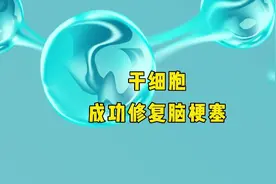 干细胞成功修复脑梗塞视频封面