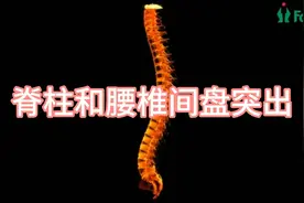 人体脊柱和腰椎间盘突出演示，精品动画！视频封面