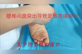 腰椎间盘突出导致足底疼痛麻木，特别指头疼的厉害，太溪穴针后