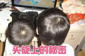 每人人头上都有头旋，头旋上的秘密，你知道多少？视频封面