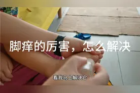 弟弟脚痒的厉害，看我5分钟解决视频封面
