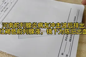 河南前列腺炎病友冲击波后排出红褐色前列腺液，镜下为陈旧出血。视频封面