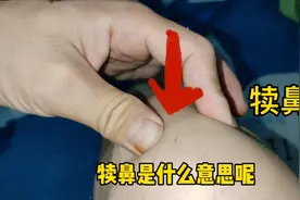足三里快速正确定位，和安全艾灸技巧分析视频封面