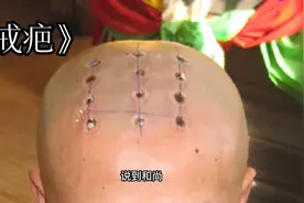 为什么和尚头上要点“戒疤”，戒疤又代表什么呢