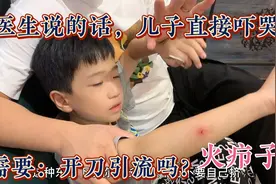 吴筅笙大宝长疖子，医生说要开刀引流，儿子直接吓哭，有必要做吗视频封面