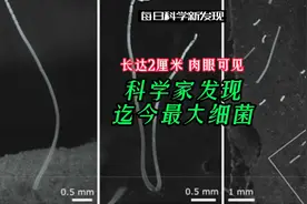 科学家发现迄今为止最大细菌，长达2厘米，肉眼可见视频封面