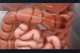 大肠是人体缺一不可的消化系统重要组成，主要是担负着人体的排便视频封面