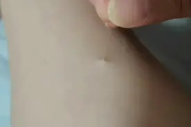突然发现自己小腿上长了一根白毛，咋回事啊？视频封面