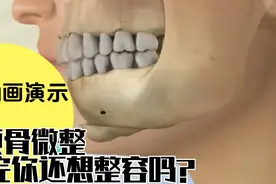 3D动画演示，原来【整容脸】是这样来的？看完你还想整容吗？视频封面