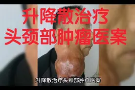 升降散治疗头颈部肿瘤医案视频封面