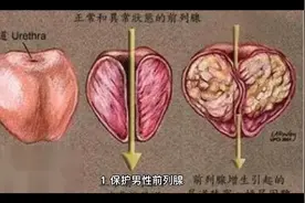 经常吃西红柿，6大好处或不请自来，但有3类人建议少吃视频封面