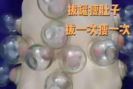 80后宝妈拔罐瘦身减肥 ， 这样拔罐瘦肚子，一天瘦两斤效果太好了