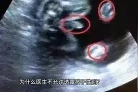 为什么医生不允许透露孩子性别？@DOU+小助手视频封面