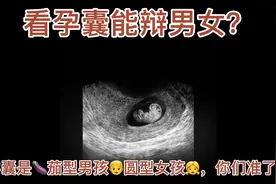 🤰看孕囊能辩男女？#孕囊是🍆型男孩，圆型女孩，你们准了嘛？视频封面
