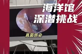 可视采耳取耳结石 #视频封面