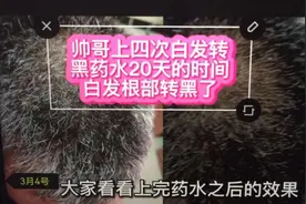 产品牛不牛效果会说话上药水20天白发根部转黑，没有第一只有唯一视频封面