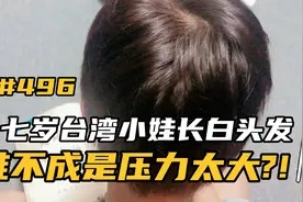 台湾打工仔：生活压太过大?七岁小娃竟然长了白头发!!视频封面