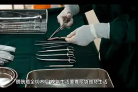 膀胱癌全切术后，要靠尿袋维持生活，是幸运还是不幸？视频封面