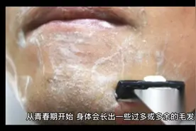 你们愿意去做激光脱毛(LHR)永久去除胡子吗？视频封面
