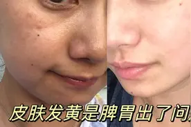皮肤发黄暗沉，2个穴位补气养血，每天按摩2-3分钟皮肤白嫩视频封面