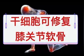 干细胞可修复膝关节软骨，干细胞移植，干细胞储存，干细胞疗法视频封面