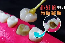 原来你刚补好的牙，又坏了，白白花了200块，这个时候该怎么办呢视频封面