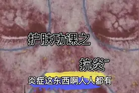 皮肤炎症，人人都有，那如何抗炎呢？一起来了解视频封面