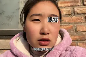 眼睛疼眼肿的看不清人了，这年过的哎，那都不去了，还是在家呆着