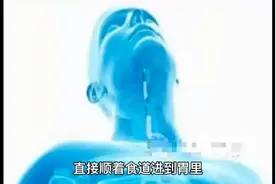 女子刷牙时仰头漱口，误吞15厘米牙刷！护士告诉你，为什么会发生