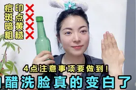 用白醋洗脸真的变白了！这4点注意事项还有人不知道吗？视频封面