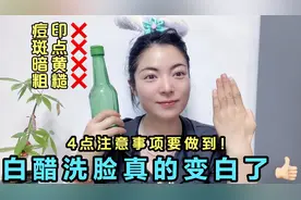 用白醋洗脸真的变白了！这4点注意事项还有人不知道吗？视频封面