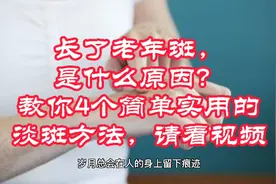 长了老年斑，是什么原因？教你4个简单实用的淡斑方法，请看视频视频封面