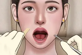 口臭的原因！小姐姐清除扁桃体结石，超级解压，一起来看看叭！