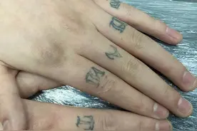 洗掉八个大戒指，一个多月效果，没有疤，常州老杨洗纹身洗眉祛疤