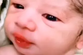 新生儿有两颗牙视频封面