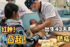 宝宝出生43天，肚脐眼还没长好，不仅凸起还红肿，太让人揪心了！视频封面