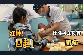 宝宝出生43天，肚脐眼还没长好，不仅凸起还红肿，太让人揪心了！视频封面