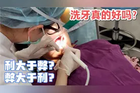 洗牙会对牙齿造成伤害么？是利大于弊还是弊大于利，今天真相大白视频封面