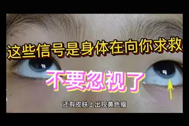 这些信号是身体在向你求救，不要忽视了，延误病情视频封面