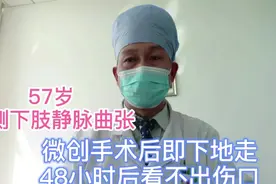 双侧下肢静脉曲张微创手术后即可下地走，48小时后看不出伤口视频封面